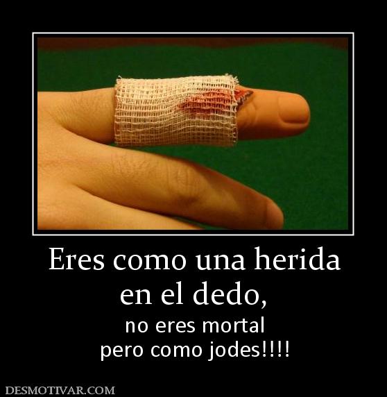 Eres como una herida en el dedo,  no eres mortal pero como jodes!!!!