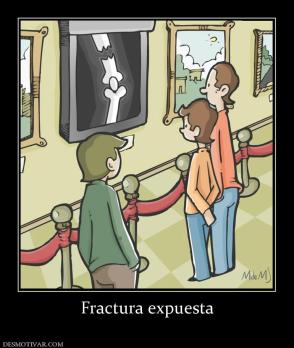 Fractura expuesta