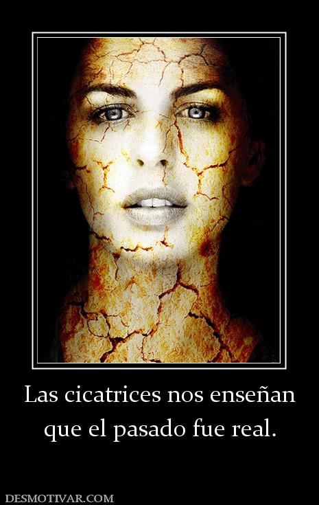 Las cicatrices nos enseñan que el pasado fue real.
