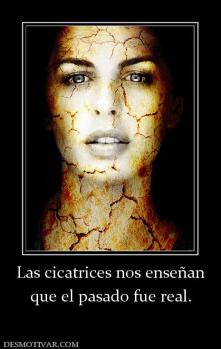 Las cicatrices nos enseñan que el pasado fue real.