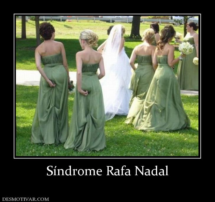 Síndrome Rafa Nadal