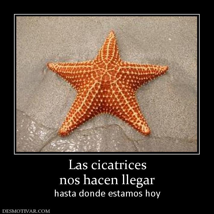 Las cicatrices nos hacen llegar  hasta donde estamos hoy