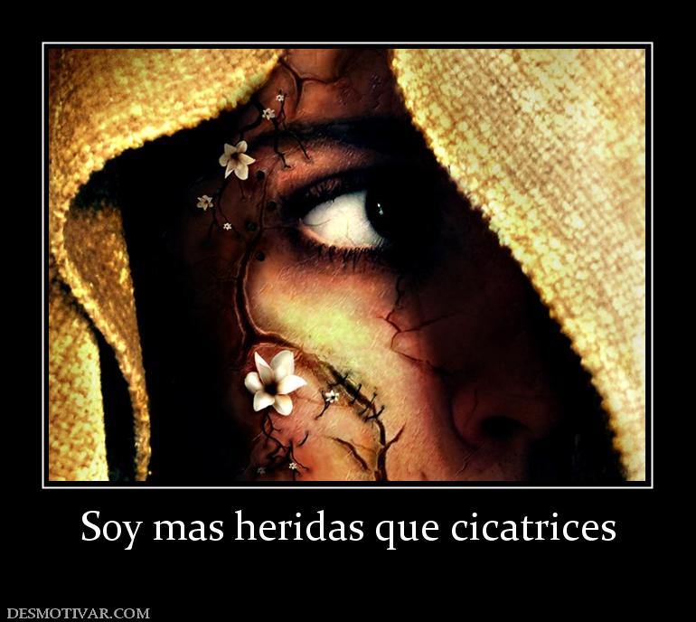 Soy mas heridas que cicatrices