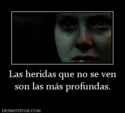 Las heridas que no se ven son las más profundas.