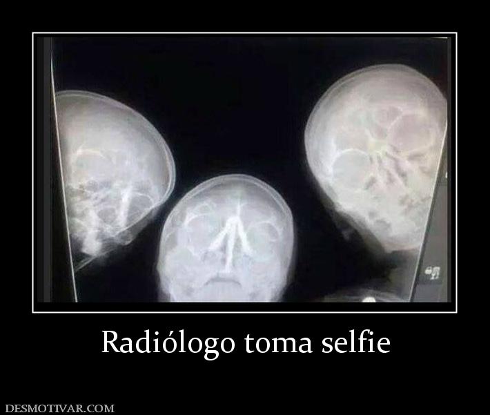 Radiólogo toma selfie