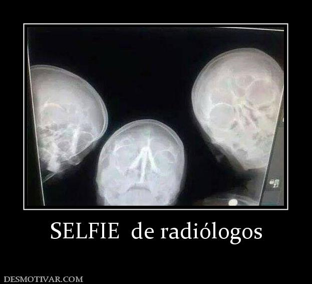 SELFIE  de radiólogos