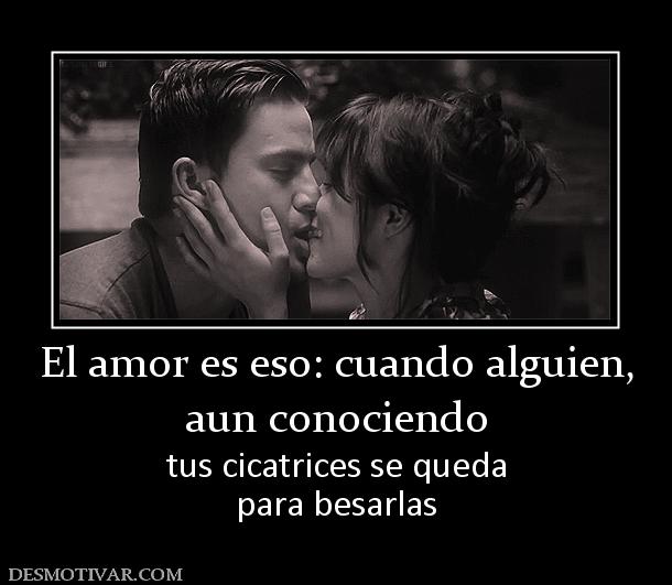 El amor es eso: cuando alguien, aun conociendo  tus cicatrices se queda para besarlas
