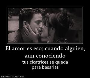 El amor es eso: cuando alguien, aun conociendo  tus cicatrices se queda para besarlas