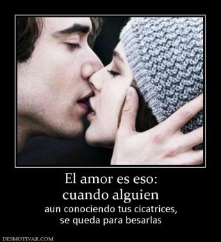 El amor es eso: cuando alguien aun conociendo tus cicatrices, se queda para besarlas