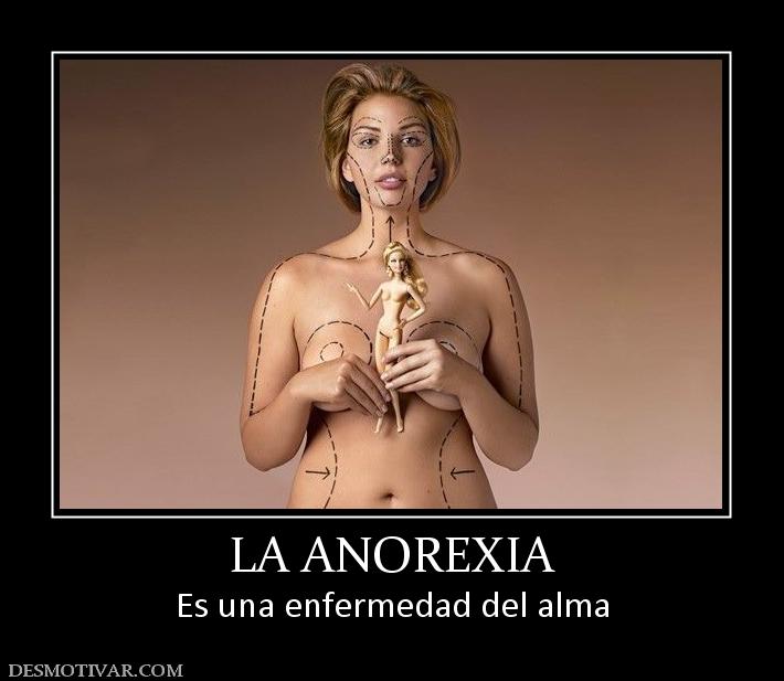 LA ANOREXIA Es una enfermedad del alma