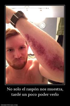 No solo el raspón nos muestra, tardé un poco poder verlo