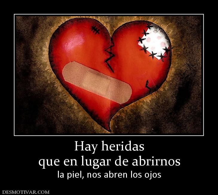 Hay heridas que en lugar de abrirnos la piel, nos abren los ojos