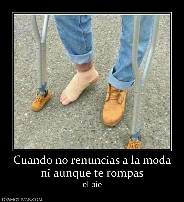Cuando no renuncias a la moda ni aunque te rompas el pie