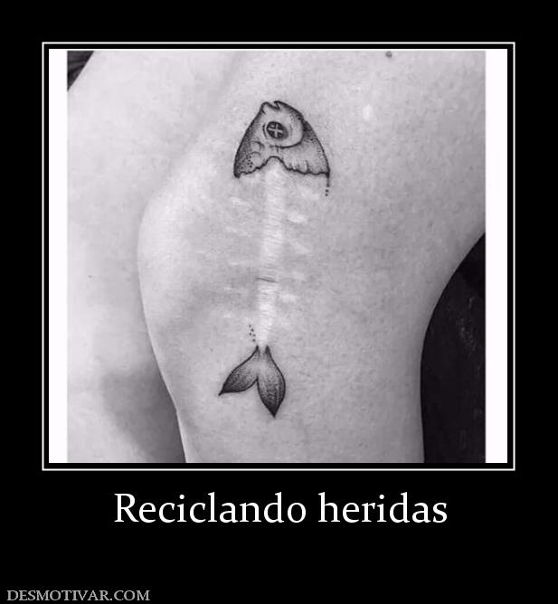 Reciclando heridas