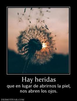 Hay heridas que en lugar de abrirnos la piel, nos abren los ojos.