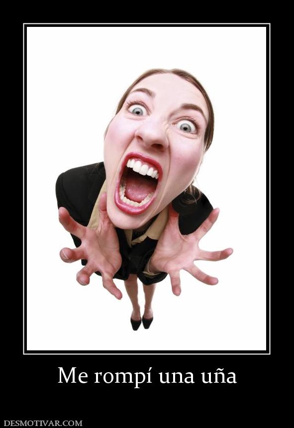 Me rompí una uña