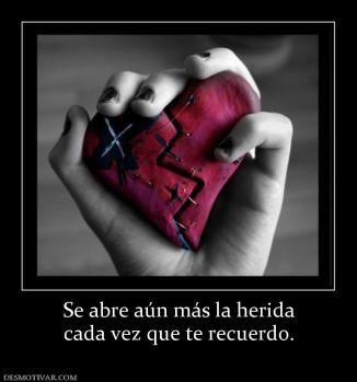 Se abre aún más la herida cada vez que te recuerdo.