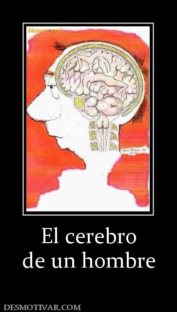 El cerebro de un hombre