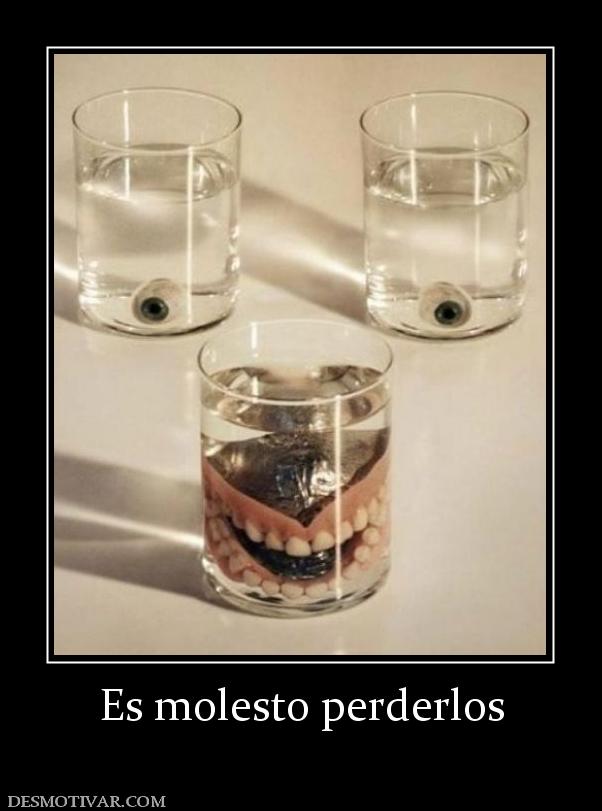 Es molesto perderlos