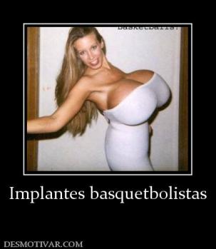 Implantes basquetbolistas