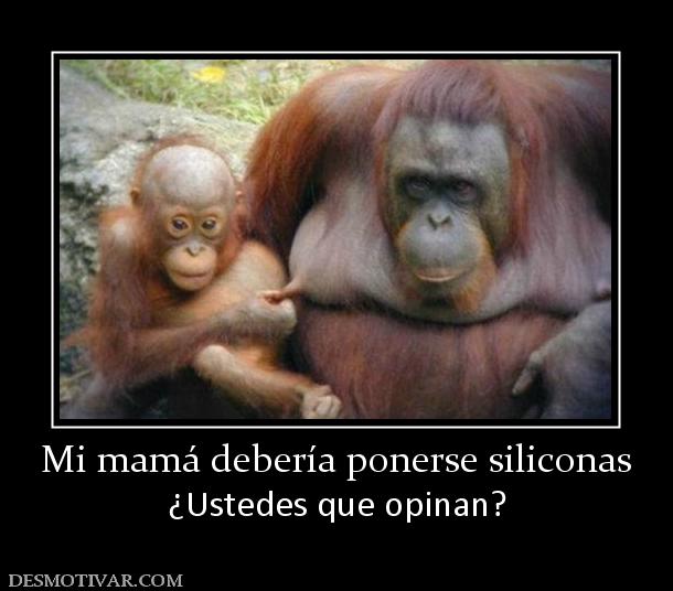 Mi mamá debería ponerse siliconas ¿Ustedes que opinan?
