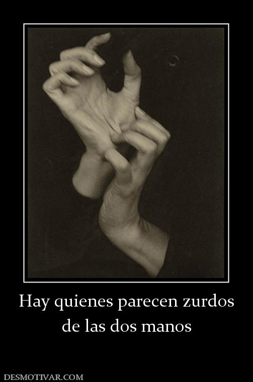 Hay quienes parecen zurdos de las dos manos
