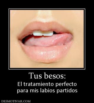 Tus besos: El tratamiento perfecto para mis labios partidos