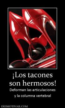 ¡Los tacones son hermosos! Deforman las articulaciones y la columna vertebral